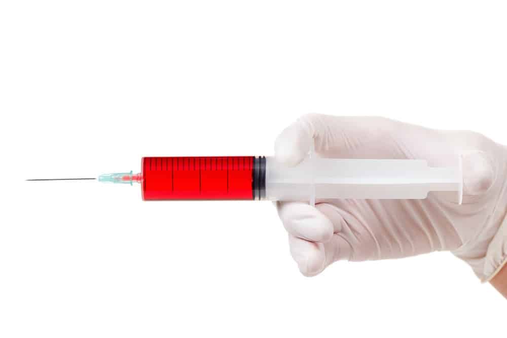 Platelet-Rich Plasma