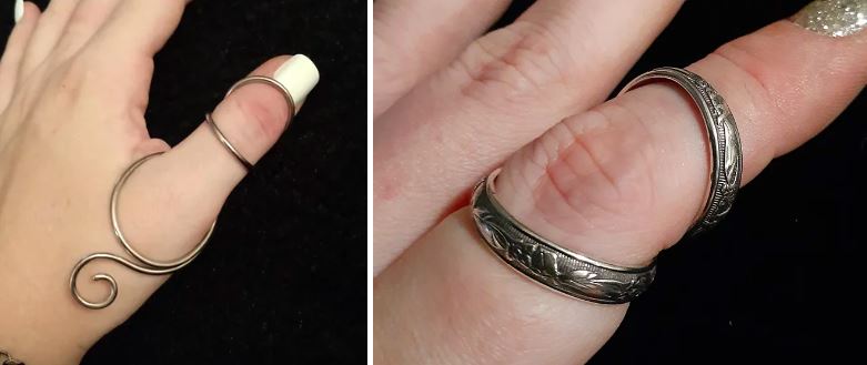 Ring Splints